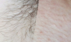 Шугаринг бикини Мастер депиляции Лиана Сумы