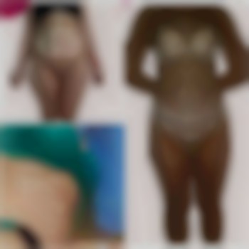 Абдоминопластика с липосакцией 360* , зоны галифе