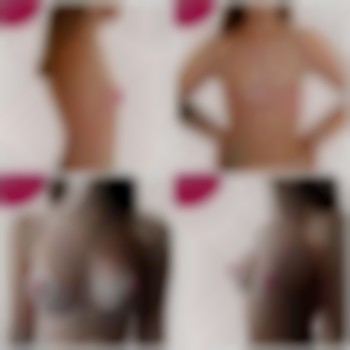 Увеличение груди импланты Polytech Replicon 240ml dual plane