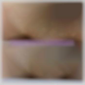 Результат зоны бикини