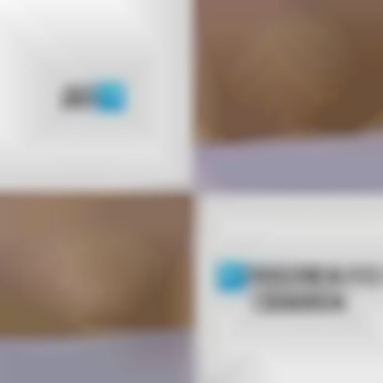 депиляция, лазерная эпиляция