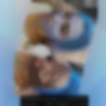 Лазерный Карбоновый пилинг+чёрная маска Zoobadgi