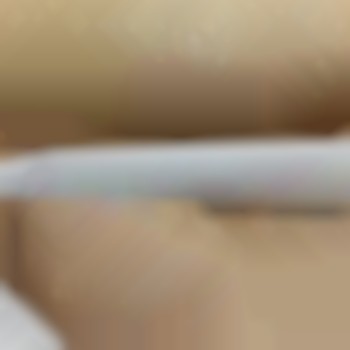 лазерная эпиляция бикини