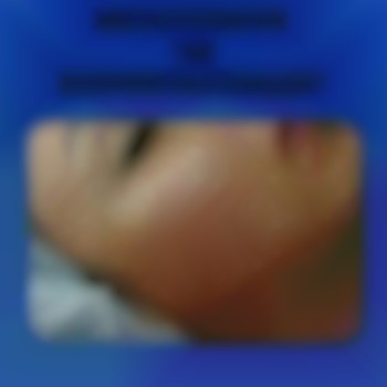 Редермалізація 
Препарат Hyalual Booster 2,2%