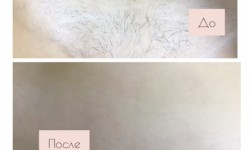 Шугарінг чоловічий Мастер депиляции Людмила Винница