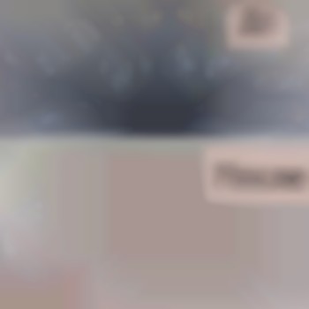 Шугаринг бікіні