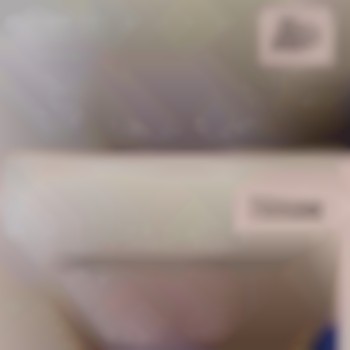 Шугаринг бікіні