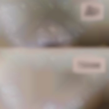 Шугаринг бікіні