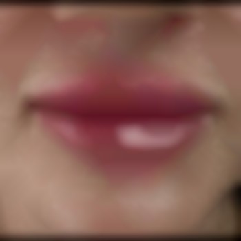 Увеличение губ
                    Косметолог-инъекционист Татьяна Одесса