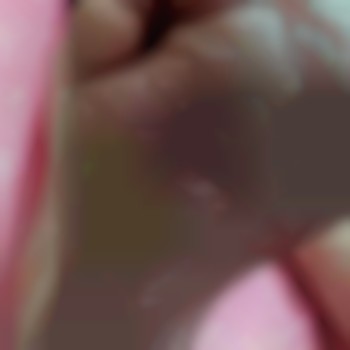 Сложная стопа. до обработки.