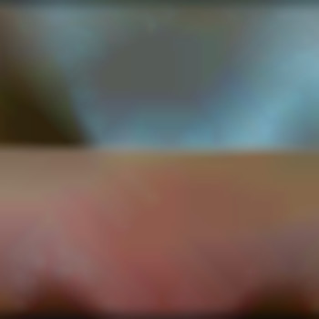 До/після 
Депіляція бікіні