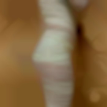 Процедурп Віскі Обгортання