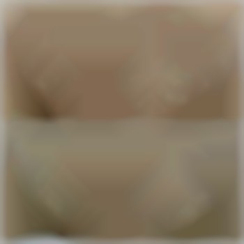 Лазерная эпиляция 3 процедуры