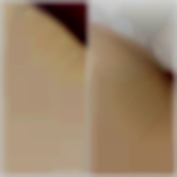 До процедури ЛЕ, та після першого сеансу