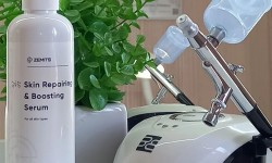 Кислородная мезотерапия "Барофорез" Косметолог-эстетист Оксана Николаев