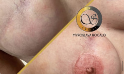 3д тату ареоли Мастер перманентного макияжа Мирослава Кропивницкий