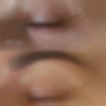 Химические пилинги для лица и глаз