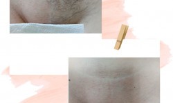 Шугаринг глубокое бикини Мастер депиляции Елена Одесса