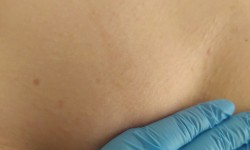 Шугаринг глибоке бікіні Мастер депиляции Людмила Одесса