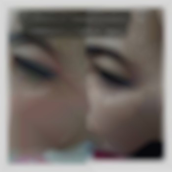 Безопераційна плазмаліфт .Період відновлення 5-7днів.Ефект 2