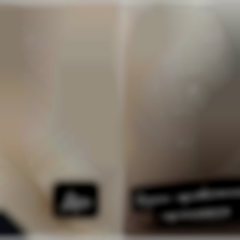  #Електроепіляція 
 #Электроэпиляция