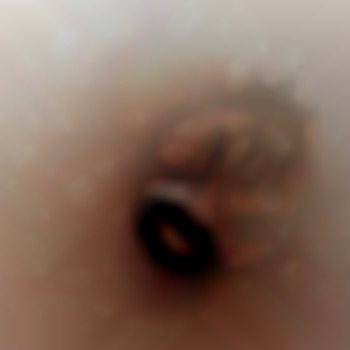 Восстановление ареолы с помощью техники микропигментации.