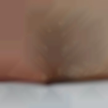 Глибоке бікіні (до/після)