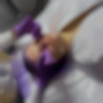 Розпалювання обличчя гелем перед чисткою