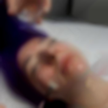 Карбоксітерапія