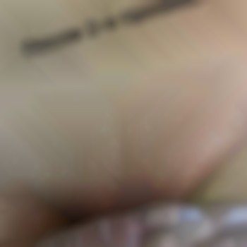 Лазерна епіляція
                    Косметологический центр NuTon Одесса