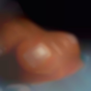 Маммопластика (увеличение груди)
                    Пластический хирург Абдель Харьков