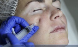 Биостимуляция Косметолог Ирина Одесса