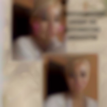 Встановлення мезоніті 1000 грн