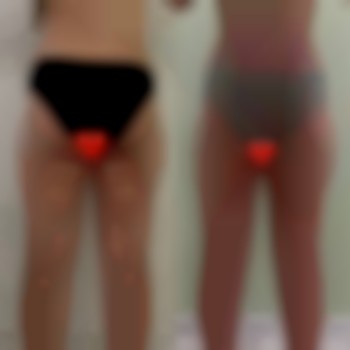 коррекция фигуры, массаж тела