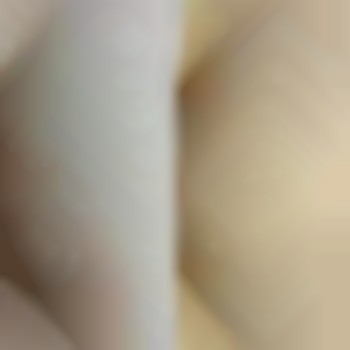 Лазерна епіляція 5 процедур 400 грн