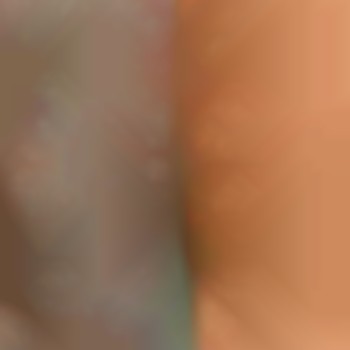 Лазерна епіляція 400 грн