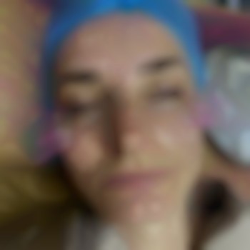 Корекція гусячих лапок