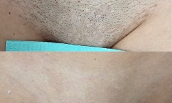 Комплекс 1 (пахви та глибоке бікіні) Мастер депиляции Анастасия Харьков