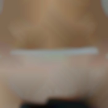 Після 3 процедур