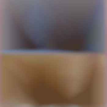 Лазерная эпиляция, фото - салон красоты Laser Impuls