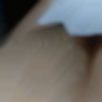 До шугаринга .Прошло 2 месяца после шугаринга