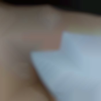 Не равномерный рост волос. После шугаринга