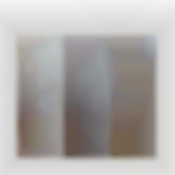 Лазерная эпиляция, фото - косметологический центр LPGClub