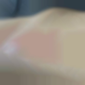 Результат зона "Бікіні"