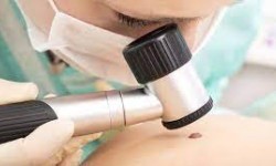 Консультація дерматолога Салон красоты Savage Киев