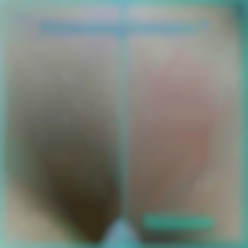 Восковая депиляция глубокого бикини