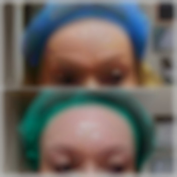 Бланч-терапія