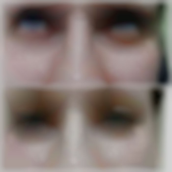 Лімфодренаж