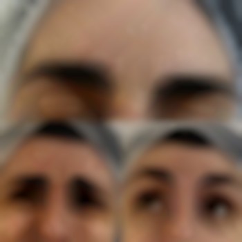 Верхня третина обличчя