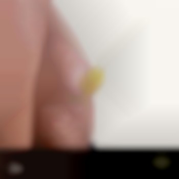 импланты в грудь